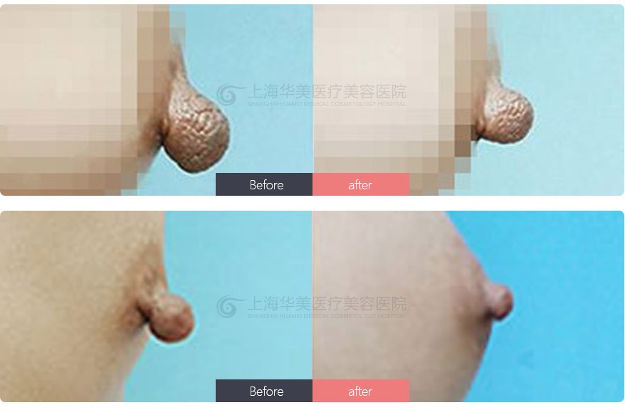 ڸôͷ